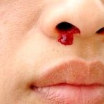 ارتباط بین خونریزی بینی و استفاده از کولر در تابستان
